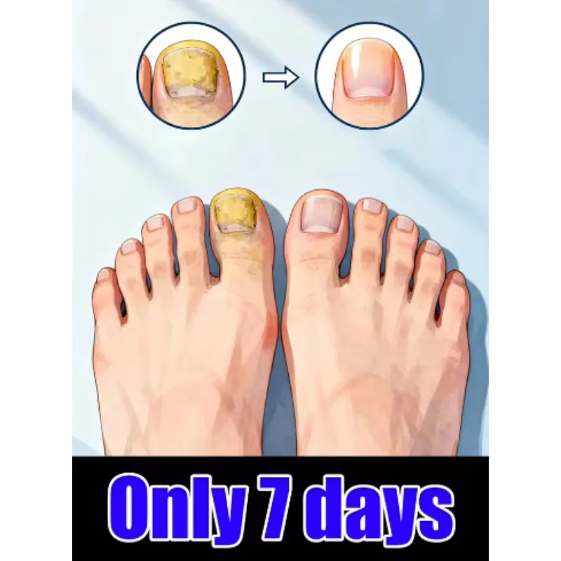 

Омоложение ht 2026 — технология предотвращения грибка — регулируемый контроль температуры и датчик безопасности