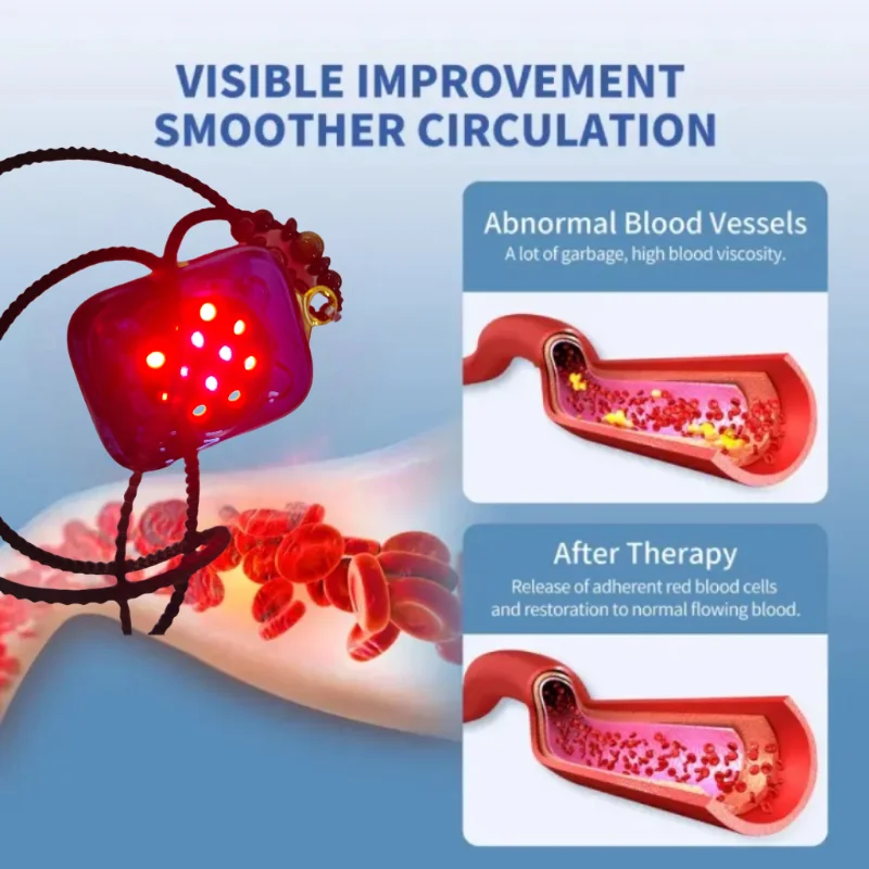 No Side Effect Laser Blood Irradiation 650nm Diode Laser Physiotherapy Promotes Blood Flow for Home Care