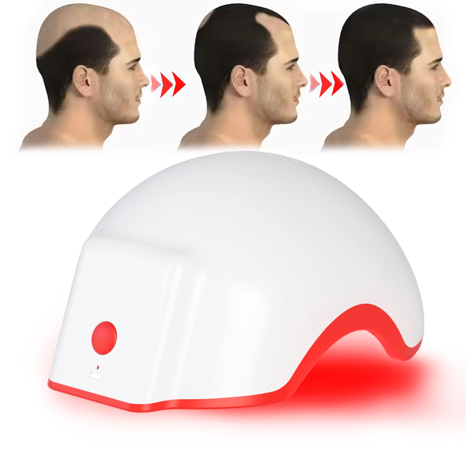 

2026 New 168 Leds Red Laser Hair Growth Helmet Fast Hair Regrowth Cap, Used For Anti-Hair Loss and Laser Hair Growth Treatment