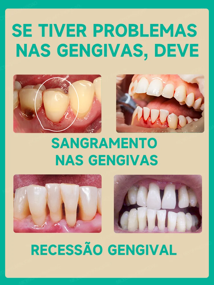 Aliviar Rapidamente A Dor De Dente, Reparar Gomas Danificadas, Gomas De Goma Saudáveis