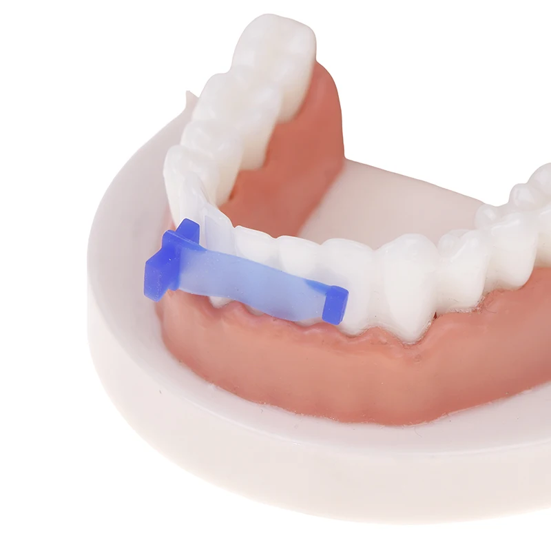 10 Uds. Matriz de mariposa Dental elasticidad tira elástica anterior y cuña materiales dentales de matriz aislante Dental