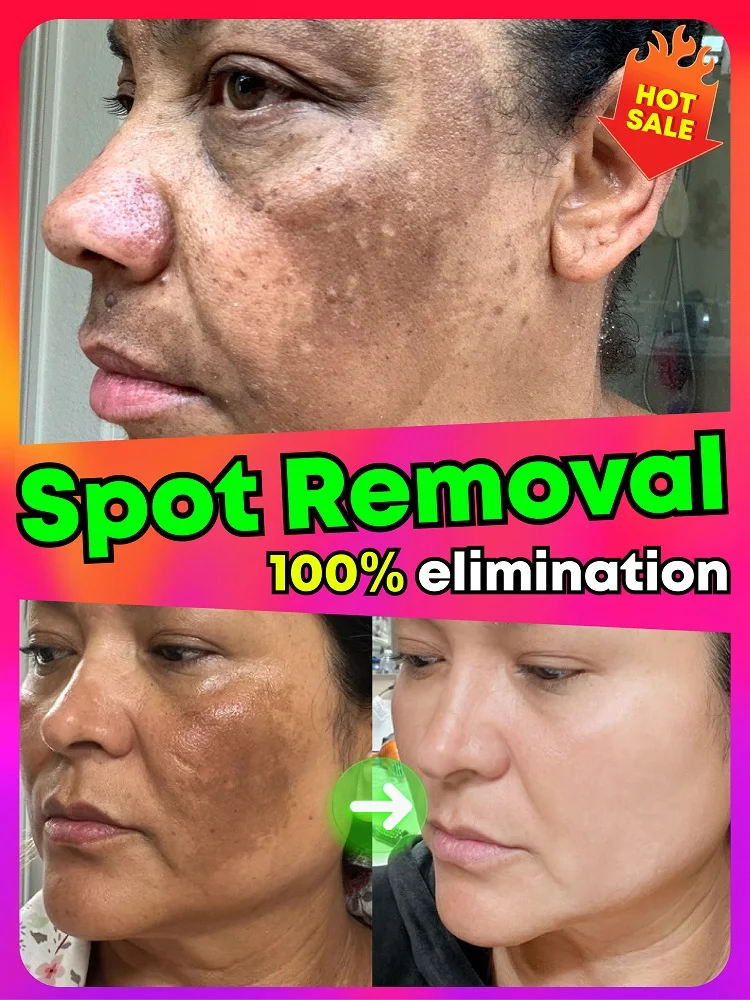 

Dark Spot Lightening Serum - Use daily for flawless skin. Lightweight, fast-absorbing texture. Suitable for both men and women.