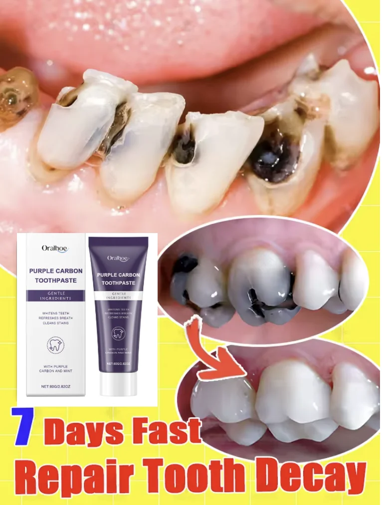 

ORALHOE Purple Carbon Toothpaste Toothpaste Brighten Yellow Teeth Remove Tooth Stain Fresh Breath Dental Cleaning Oral Care