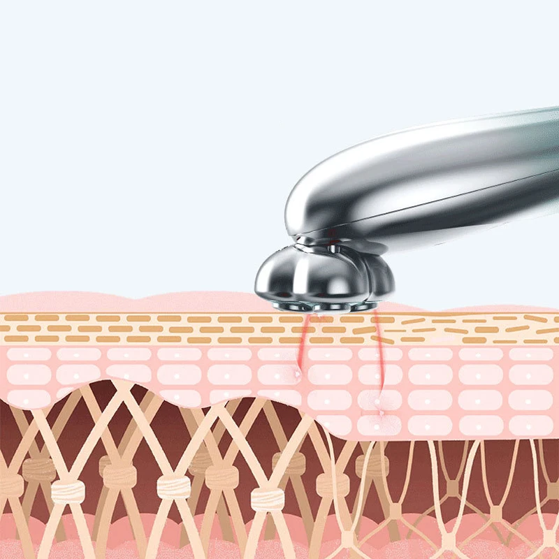 미세 전류 미용 기기 RF RF 눈 퍼밍 주름 감소를위한 노화 방지 기계 페이스 리프트 아이 마사지 휴대용 컴포트