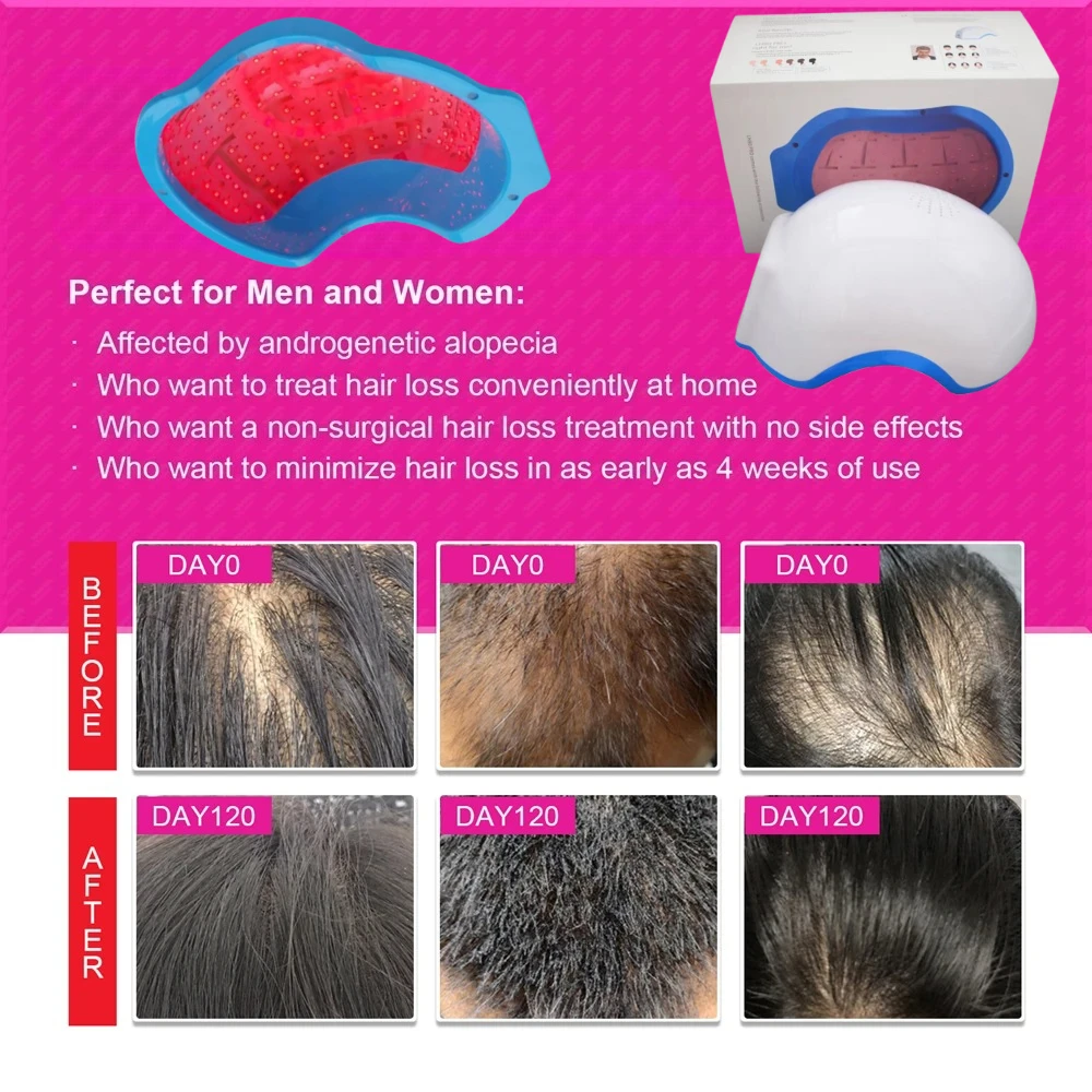 

Laser Hair Growth Helmet Rechargeable Wireless LLLT Cap for Men/Women Hair Regrowth