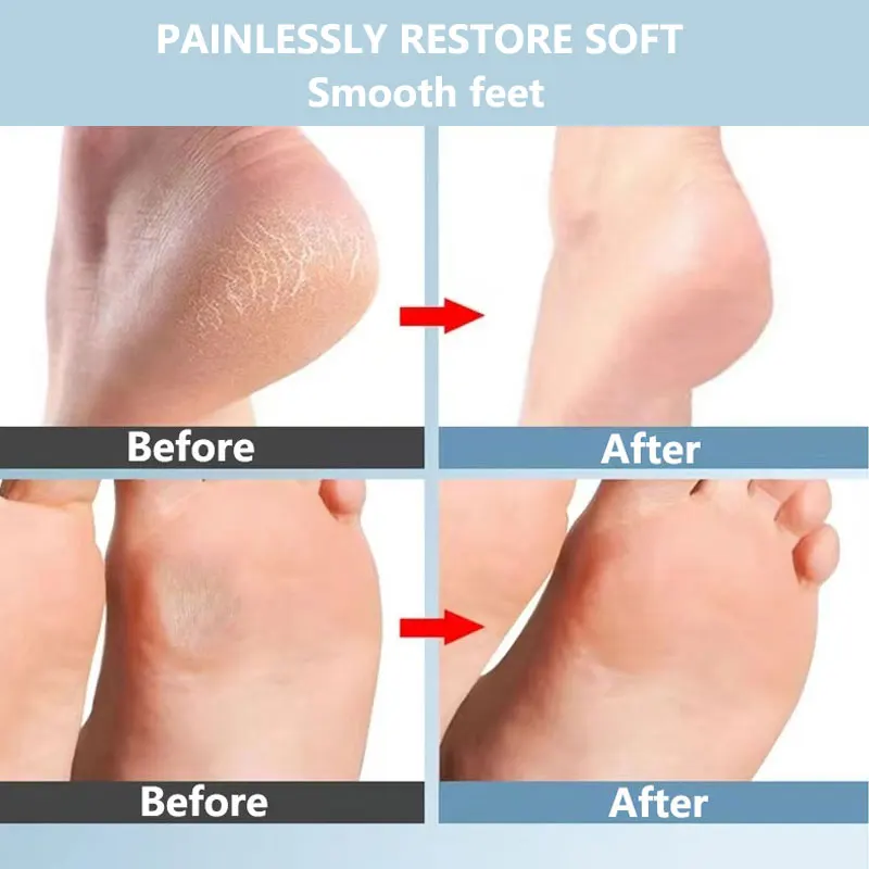 نانو الزجاج ملف القدم الكالس مزيل كعب مكشطة في دش القدمين الغسيل مزيل الجلد الميت باديكير القدم العازلة للأقدام الناعمة