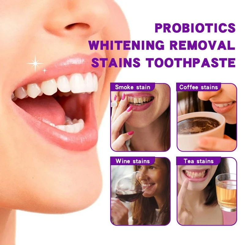 Probiotic Toothpaste Deep Cleaning Tooth Stains Tartar Calculus Oral Odor Fresh Breath Gingival Repair White Teeth Toothpaste