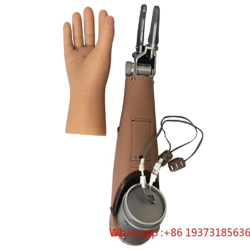 Myoelectric Hand Prostheses Two Degrees For Above Elbow Prosthetic Hands