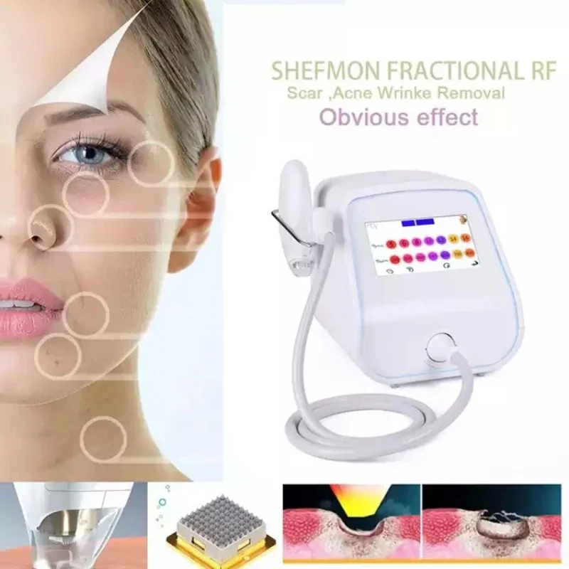 Allfond Tixel Thermal Skin Rejuvenation Beauty Machine with One Handle for Scar Removal