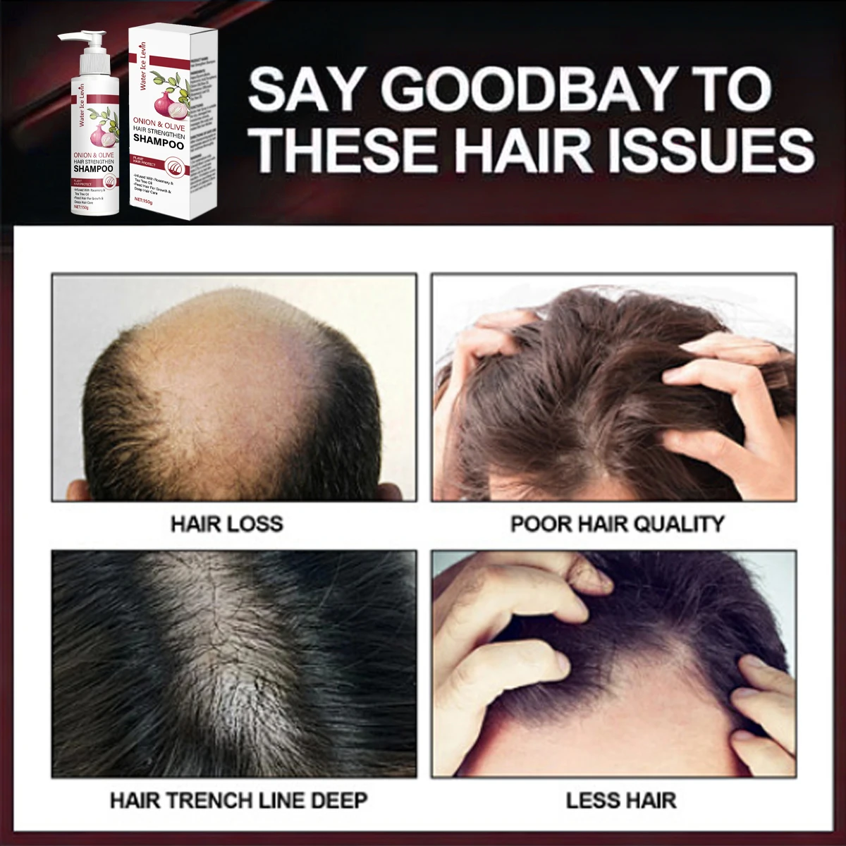 شامبو تقوية شعر البصل والزيتون مع زيت البيوتين وإكليل الجبل للنمو والرطوبة والعناية بفروة الرأس - للشعر الجاف التالف #3