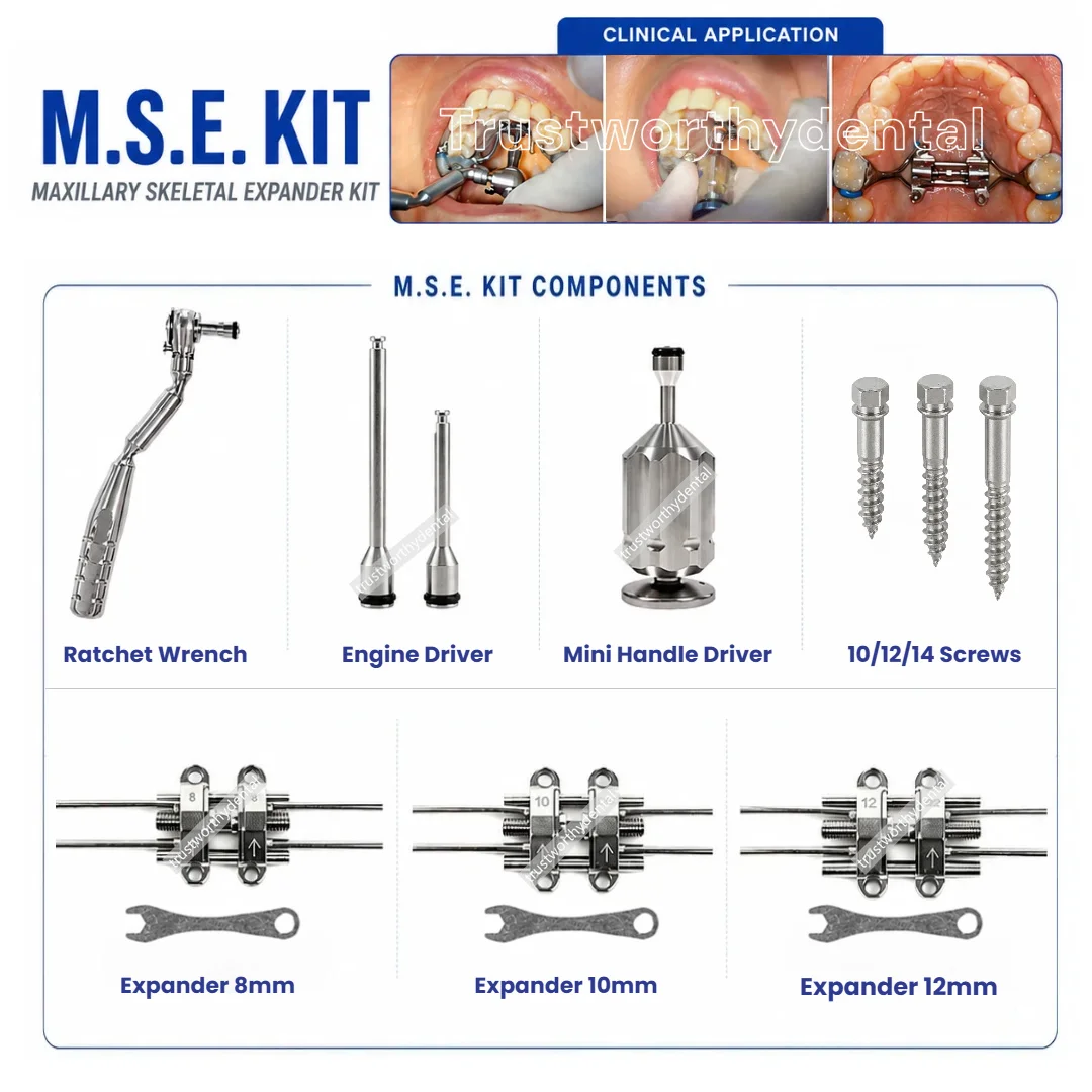 Dispositifs d'expansion squelettique maxillaire MSE pour orthodontie dentaire, vis d'implant 8/10/12mm, clé à cliquet/mini tournevis manuel, kit de démarrage 1