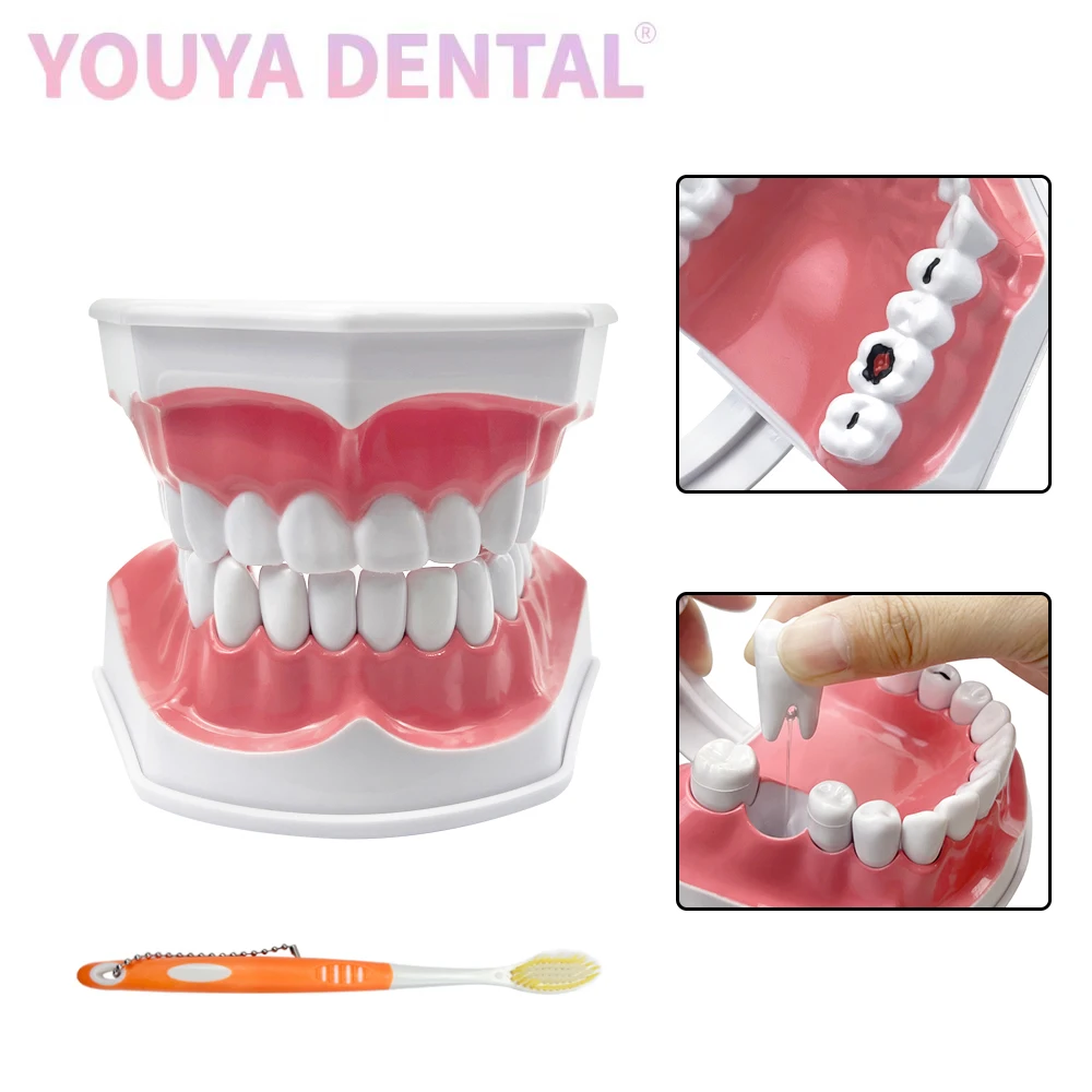 Dental Brushing Education 2 Times Teeth Model With Toothbrush Detachable Teeth & Tongue Caries Pathology Research Training Model