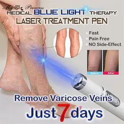 Stylo laser de thérapie à la lumière bleue chaude, traitement des varices, cicatrice douce, traitement de l'élimination de l'acné, massage relaxant