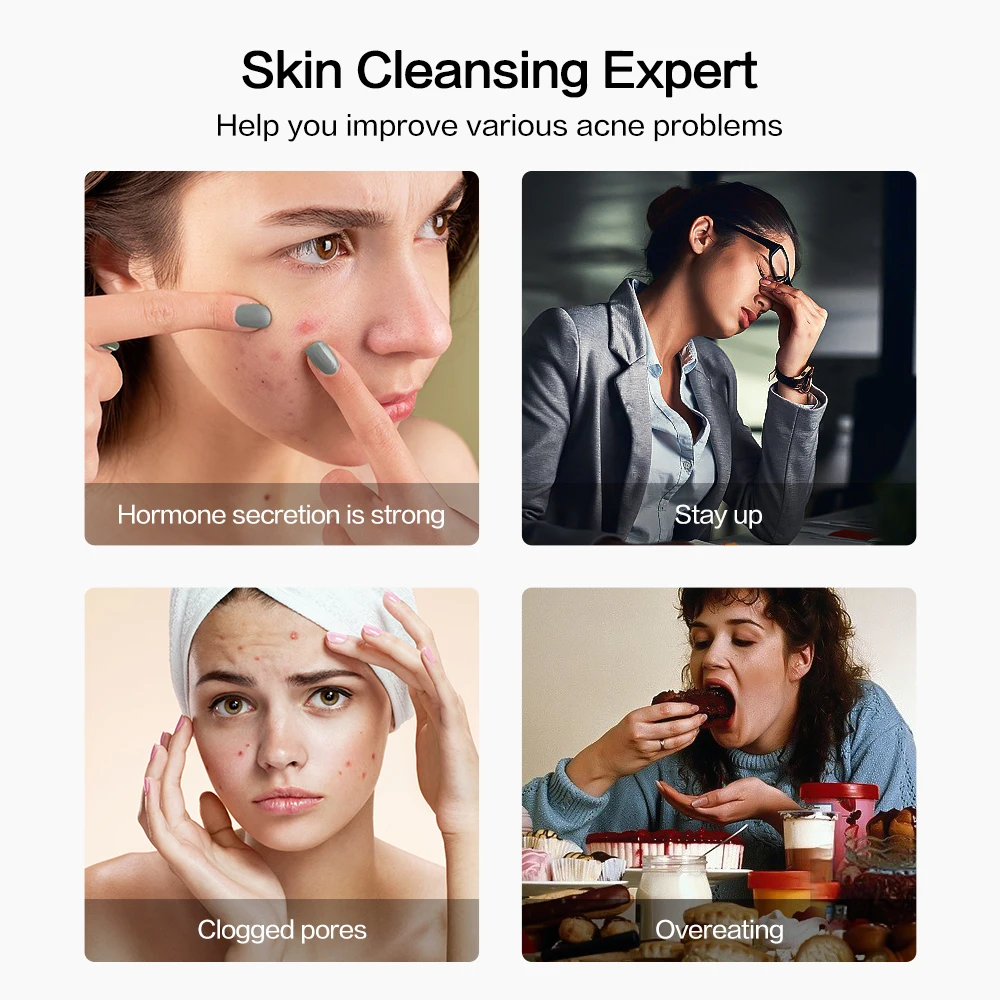 Visual Acne Cleaner Blackhead Remover Acne Needle Squeeze Pore Cleaner Pimple Black Dots Extractor Facial Cleaning Beauty Device