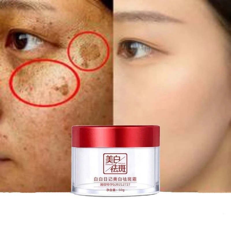 Effective Whitening Freckle Cream Remove Dark Spot Face Cream Removal Melanin Melasma Lighten Brighten Skin Care Korea Cosmetic