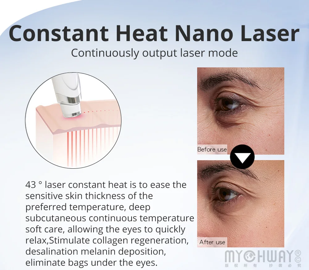 Urządzenie do mikrodermabrazji diamentowej 3 w 1 do domowego oczyszczania twarzy i pielęgnacji okolic oczu