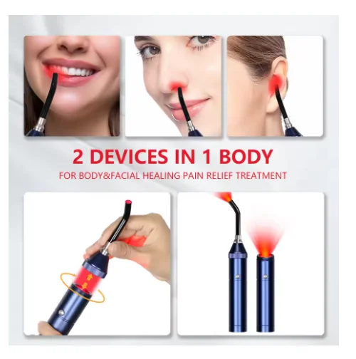 

Cold Sore Laser Therapy Device Physiotherapy Mouth Ulceration Blisters Herpes Infection Pain Relief Ulcer Medical Laser Care