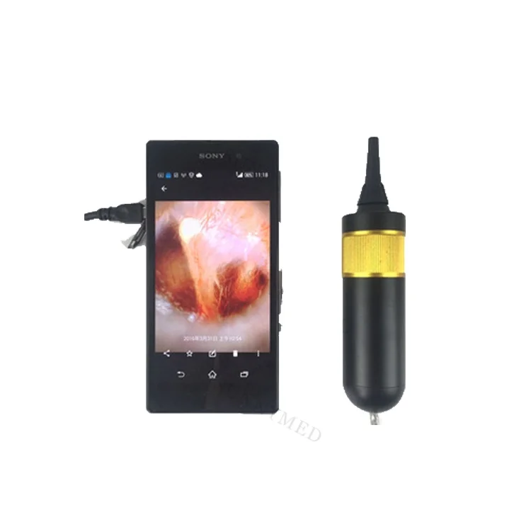 

2025 hot sale SY-G046 Diagnostic Set Ophthalmoscope Otoscope for Surgical Medical Digital Video Otoscope