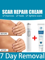 Laser whitening for Repair Scars