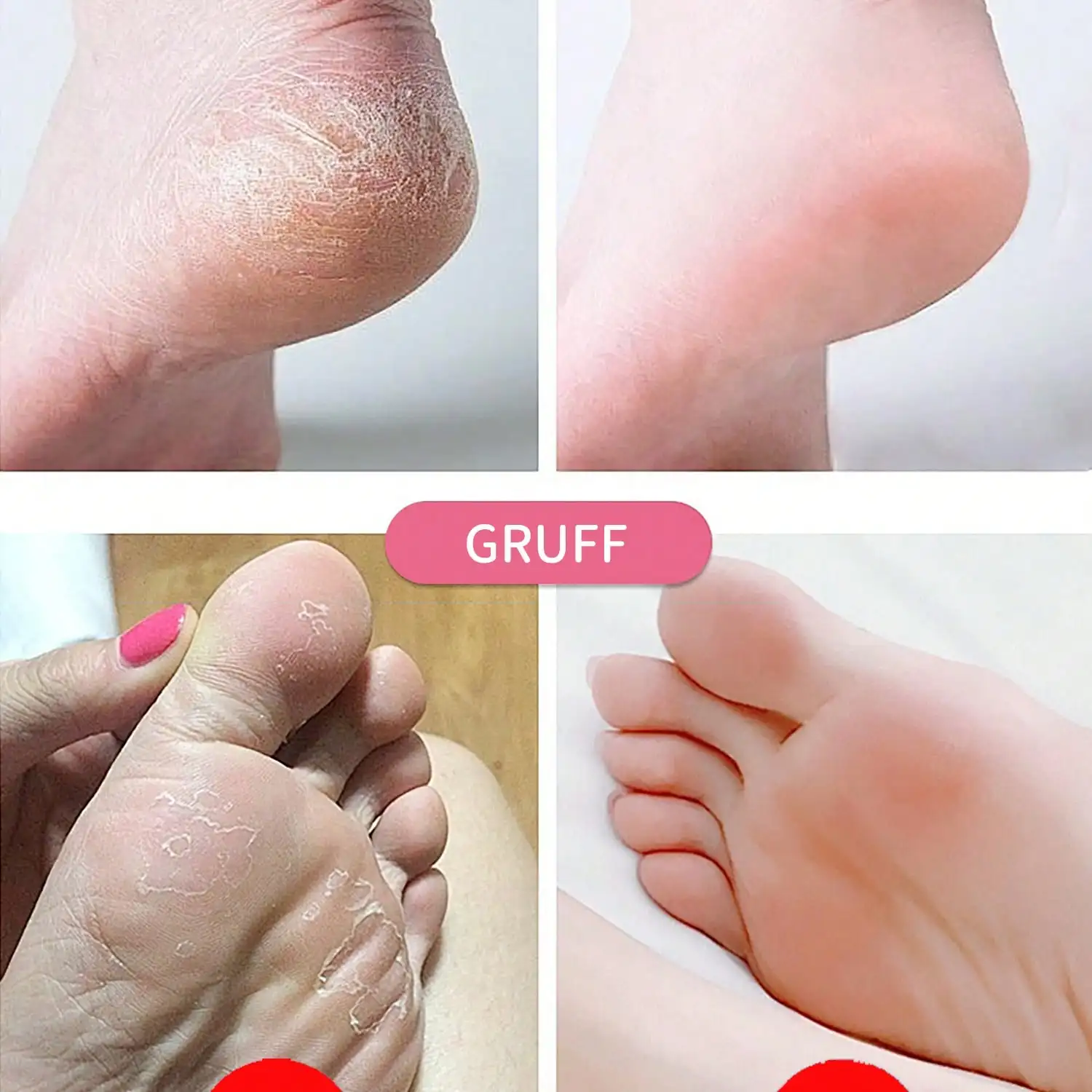 Foot Massager - 2-In-1 Foot File, With Sandpaper Disc And Adjustable Speed Foot File, 9 Speed Removal Device, For Feet, Valentine's Day Gift For Foot Care Tools