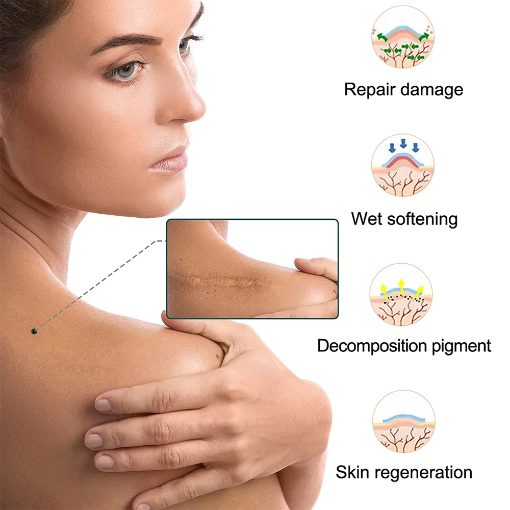 1/2 Professional Silicone Scar Sheets Scars Treatment - Reusable Silicone Scar Strips Type for Keloid,C-Section,Surgery,Acne et