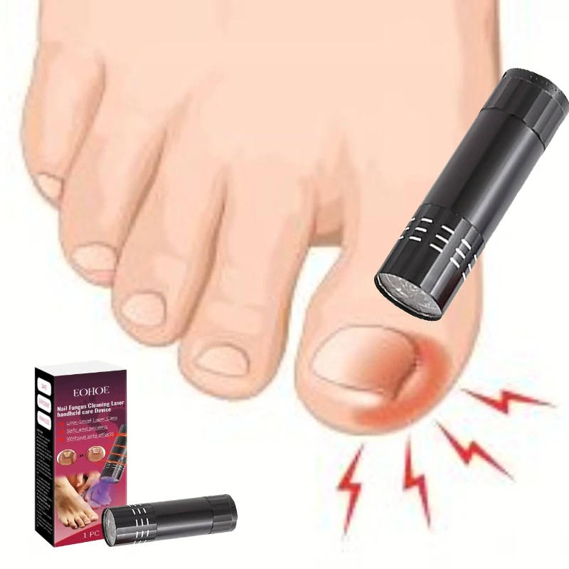 

Nail removal, nail fungus, foot care, laser pen