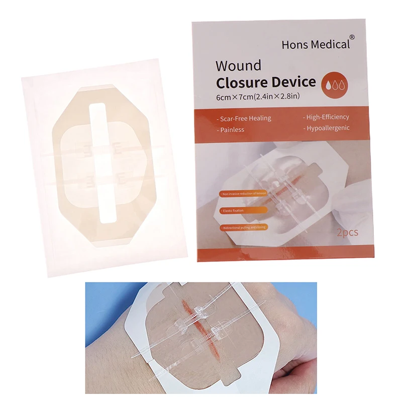 2Pcs Outdoor Portable Zipper Band-Aid Zipper Tie Wound Closure Patch Hemostatic Patch Wound Fast Suture Zipper Band-Aid