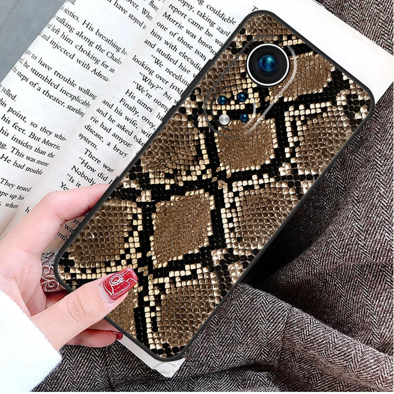 Animal Print Wildlife Fur Skin Case For Honor X9b X8b X6 X7 X8 X9 X6a X7a X8a X9a Honor 70 50 90 Lite Magic 6 5 Pro Cover