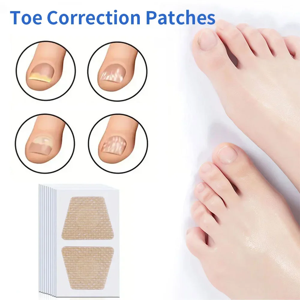Ingrown Toenail Correction Tool Nail Filling Pad Ingrown Toe Nail Treatment Elastic Patch Straightening Clip Brace Pedicure Tool