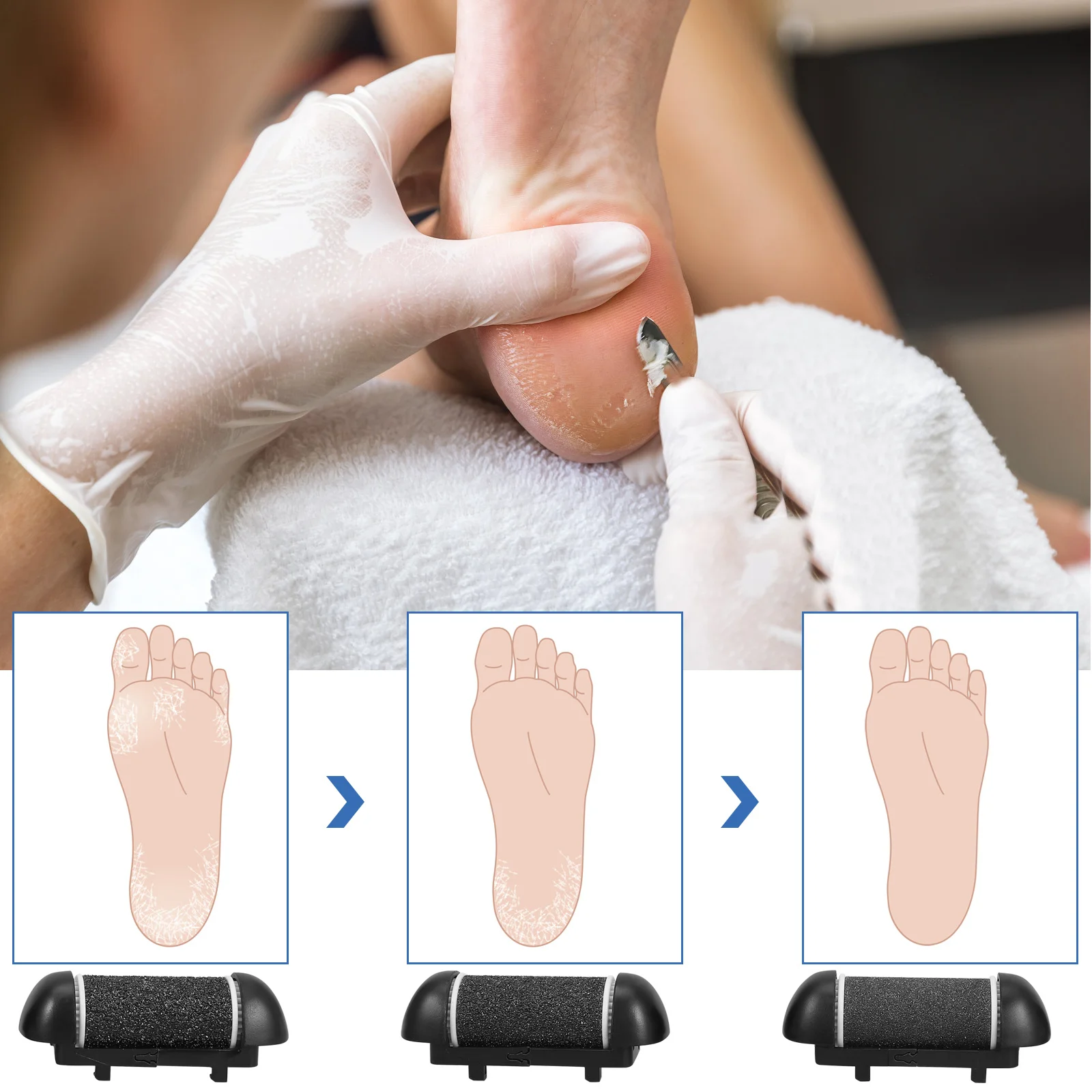 

3pcs Replacement Roller Refill For Electric Foot File Callus Remover Pedicure Tool Rough Skin Removing Foot Care Set Pedicure