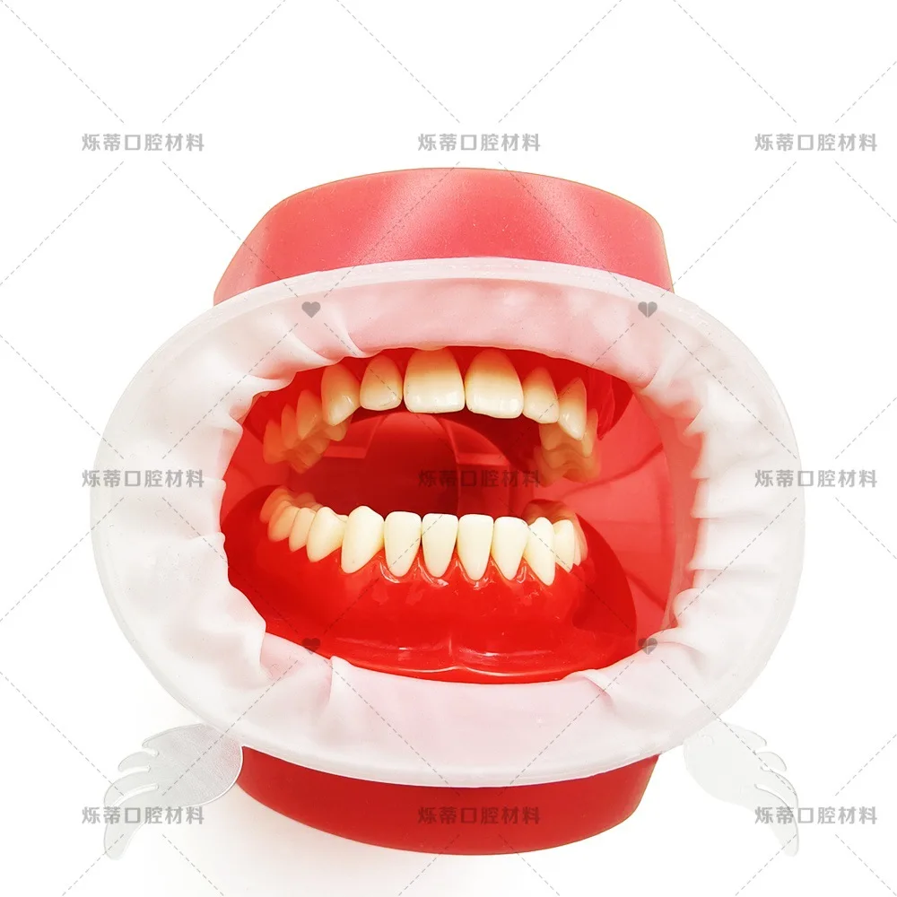 Dental Retractor Mouth Opener Oral Lip Guard Cheek Retractor Teeth Whitening Oral Care 5pcs