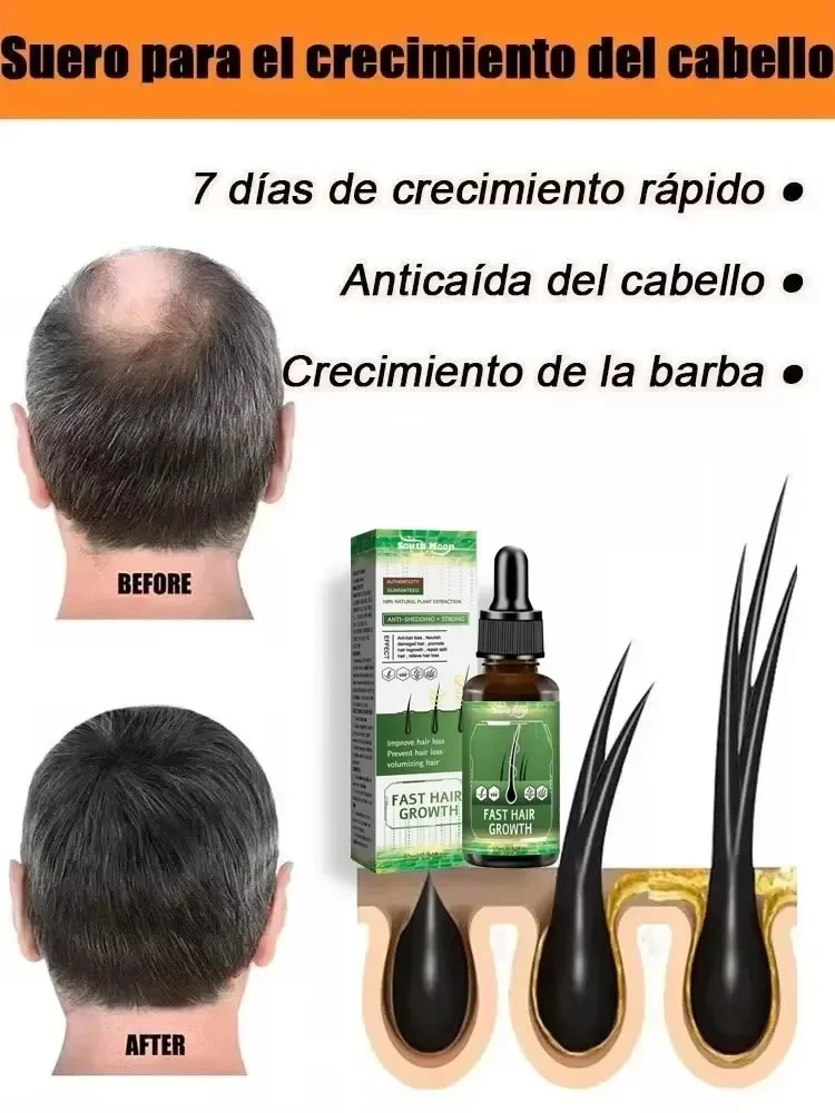 

Hot selling product, 99% of buyers buy again, have more and more hair, say goodbye to baldness, thick hair
