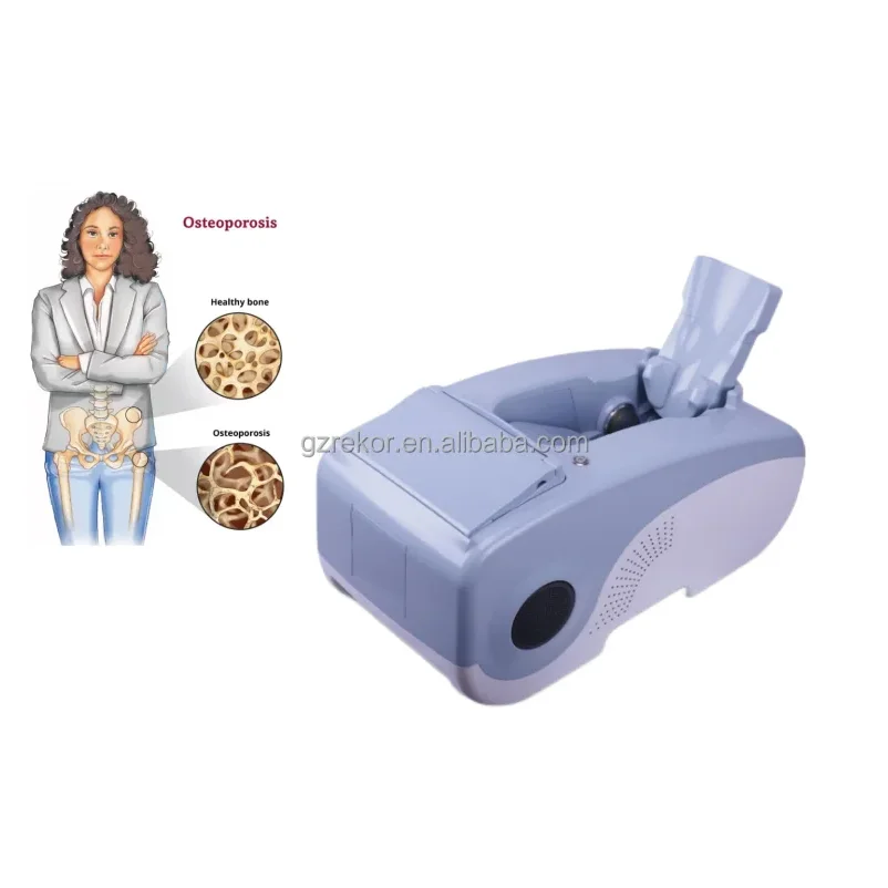 Best quality Ultrasound Bone Densitometer scanner Calcaneus Osteoporosis testing equipment for adult and children