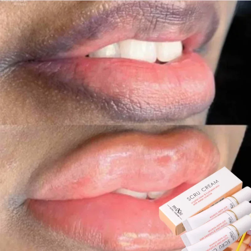 Lip Lightening Balm Dark Black  Removal Exfoliation Pigmentation Fade Dull Pink Balm Anti-Crack Moisturizing Lip Care