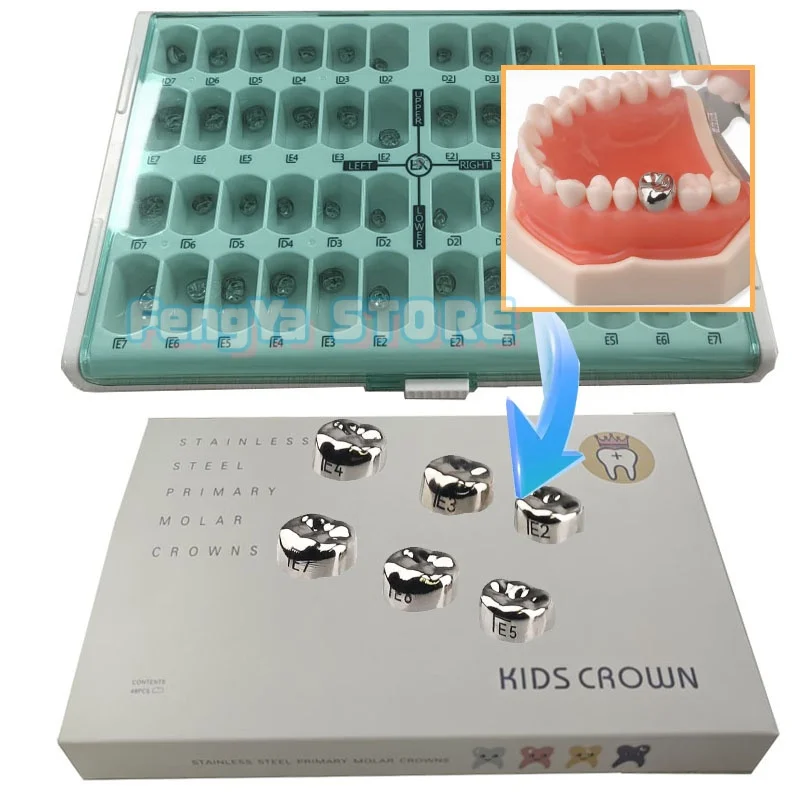 

48Pcs/Box Dental Stainless Steel Kid Crowns Preformed Metal Crown Temporary Crowns Dentistry Orthodontic Material Therapy Tools