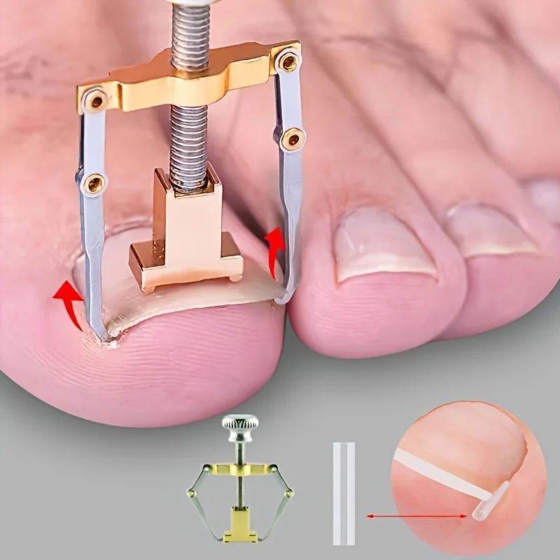 51pcs Professional-Grade Recessed Toenail Trimming Kit with Ingrown Toenail, Soft-Touch Nail Care Tools & Unscented File - Complete for Painless Pedicure, Painless Nail Removal, Foot Hygiene Care (/)