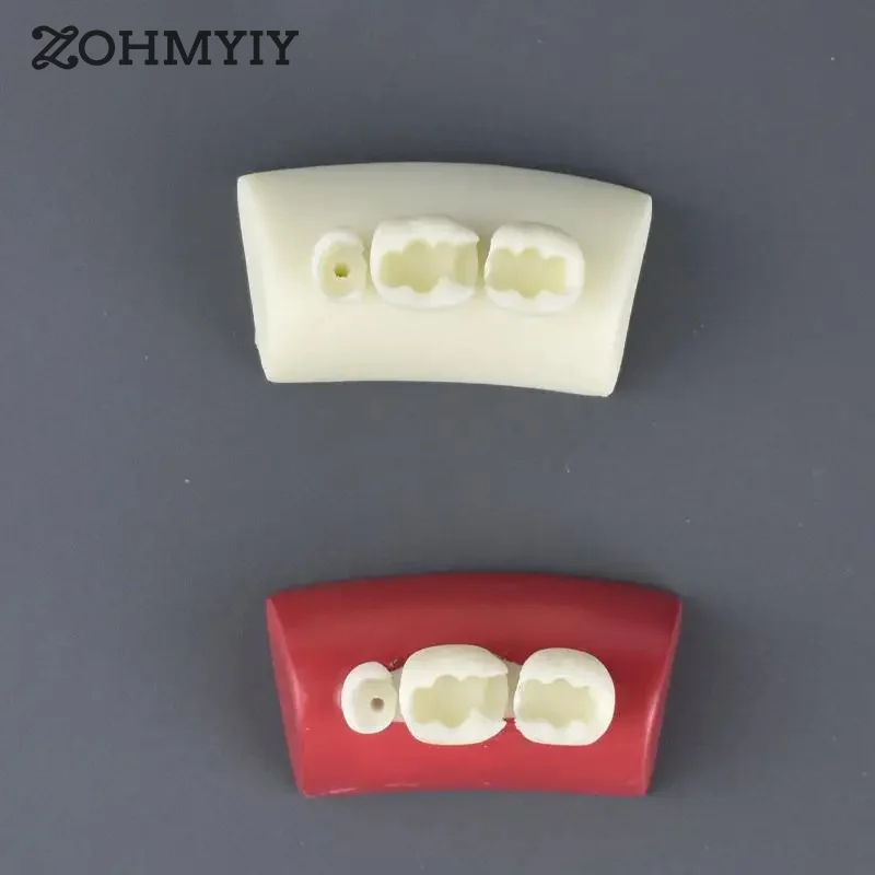 

1PCS Oral Filling Model Dental Inlay Exercise Model Block Filling Exercise Typodont Resin Materials For Dentistry Teaching Stud