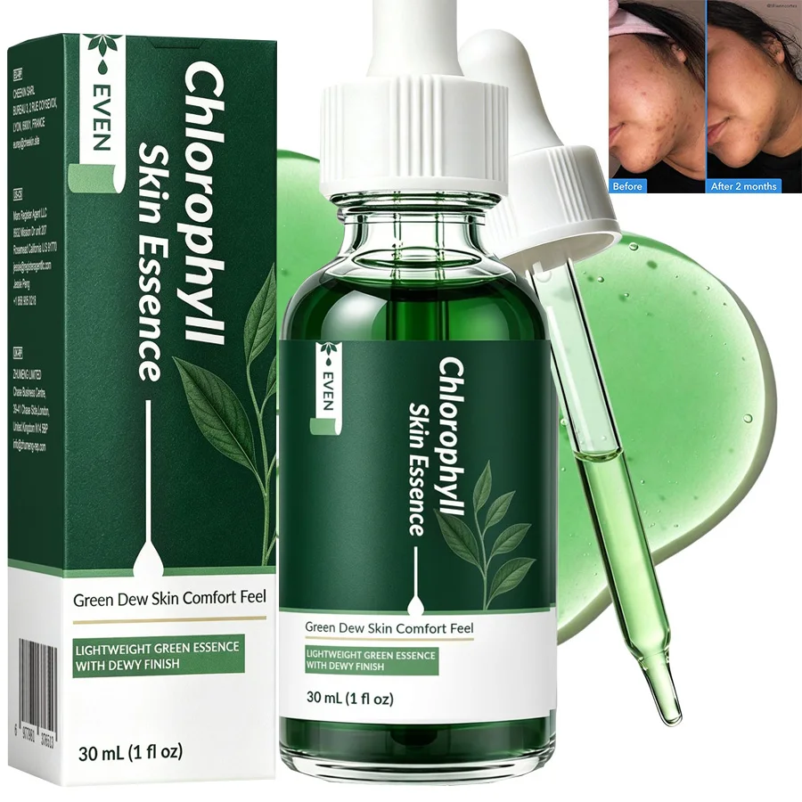 Chlorophyll Discoloration Serum, Sensitive Skin Glow Friendly Spot Fading Serum to Target Spots, and Redness Dark Spot Corrector