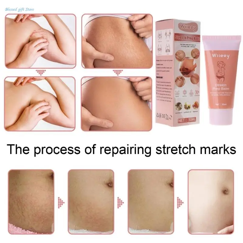 Removes Stretch Mark Cream To Remove Postpartum Obesity Pregnant Women Repair Anti-Aging Anti-Winkles Firming Body Crea