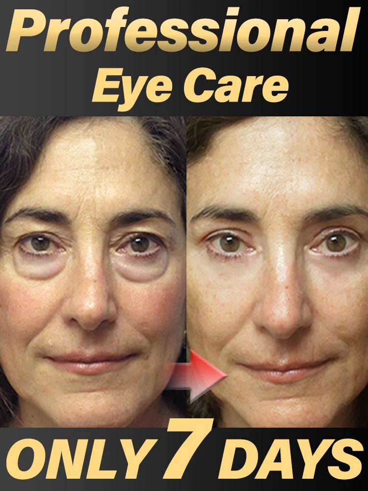 99% of people will purchase the Eye Care Bags Under The Eyes Disappear