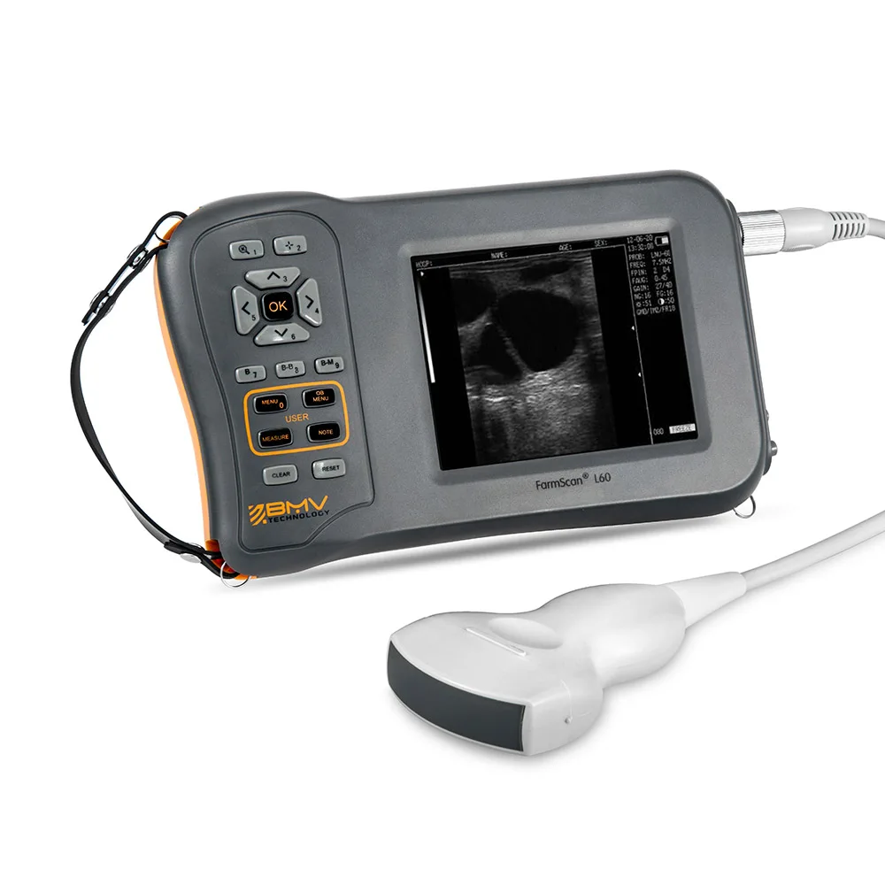 

Hot sale portable L60 ultrasound machine china