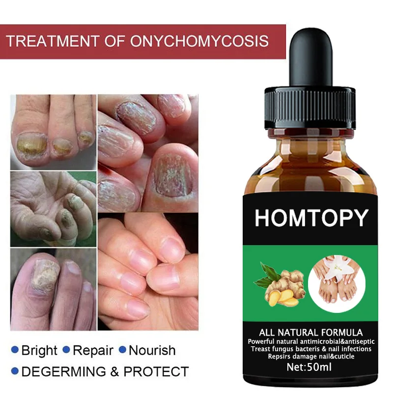 7 Days Nail Fungal Treatment Essence Oil Foot Toe Nail Fungus Removal Serum Repair Onychomycosi Anti Infection Gel Care Products