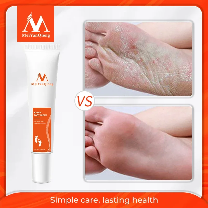 

Herbal Anti Cracked Cream Anti-Drying Heel Cracking Exfoliation Dead Skin Remove Foot Mask Softening Moisturizing Hand Feet Care