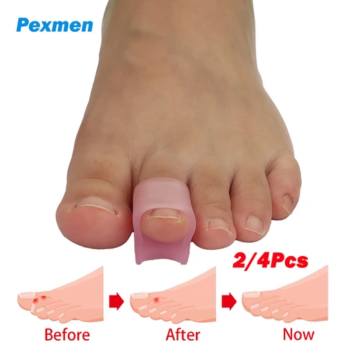 Pexmen 2/4 Uds Corrector de punta de martillo férulas para dedos de los pies alisadores de dedos de Gel suave realizando garra torcida doblada y dedos de martillo