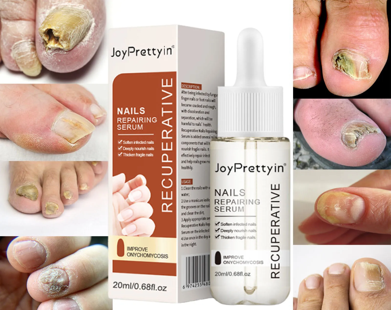 爪真菌治療エッセンス爪真菌症を除去修復損傷した爪を修復抗足指感染症ジェル足クリーム除去爪真菌