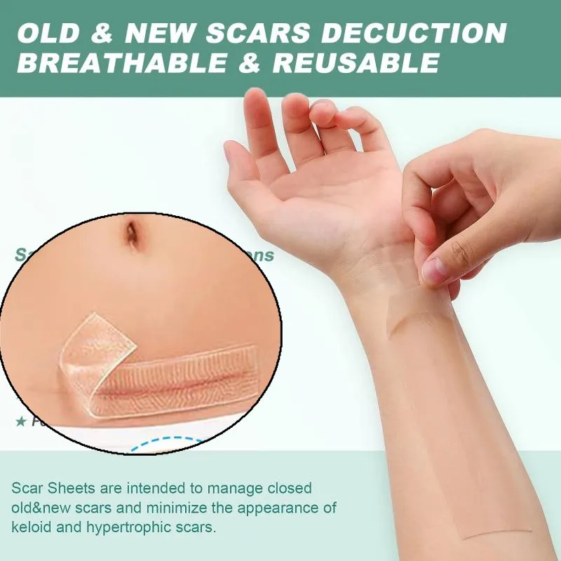 

1 рулон 150/300 см силиконовые листы для шрамов медицинского класса многоразовая лента для шрамов для Keloid хирургии ожогов акне водонепроницаемый инструмент для ухода за телом