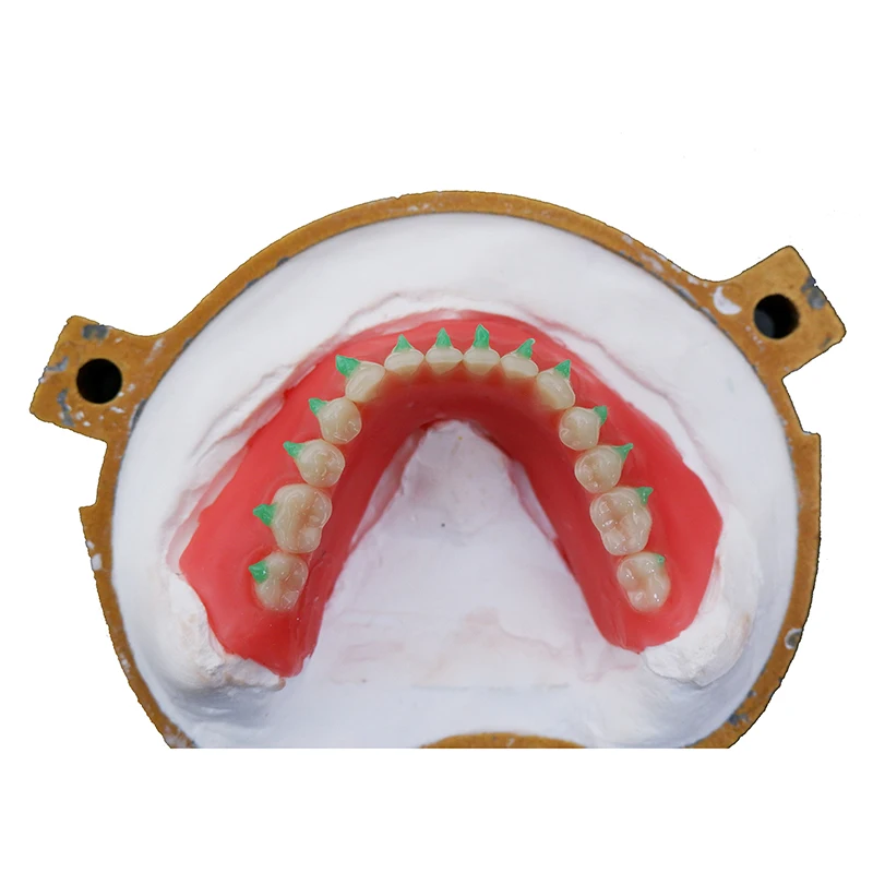 2Pcs/box Dental Material UV Light Cure Adhesive Full-mouth Ddsorption Denture Injection Fixative