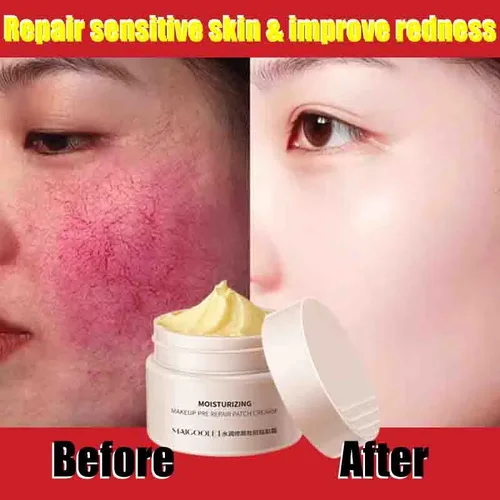 Crema reparadora de enrojecimiento Facial mejora la sequedad de la piel sensible crema hidratante loción calmante eliminación Rosacea Cosméticos Coreanos