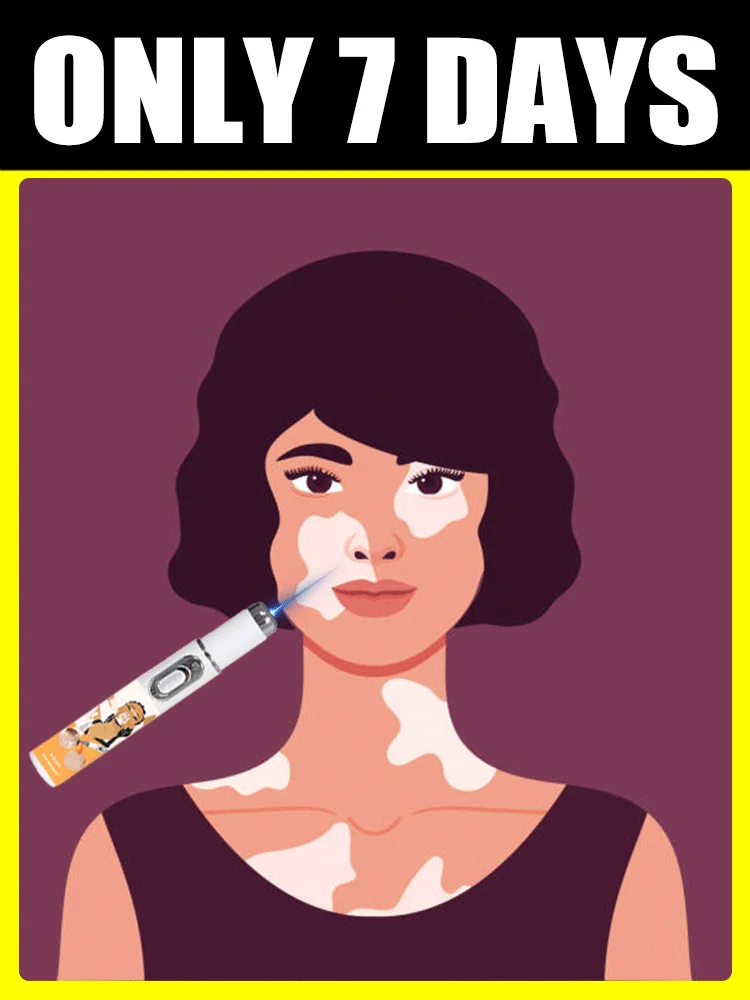 

Laser Generation-2 Save Vitiligo in 7 Days for Men Women All People Body care tools