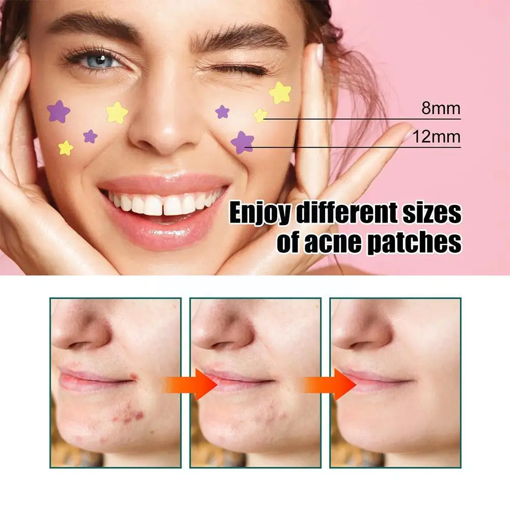 New Star Pimple Patch Stickers Dazzling Colorful Face Acne Removal Skin Spot Sticker Beauty Face Care Care Makeup Tool Conc T3Z1